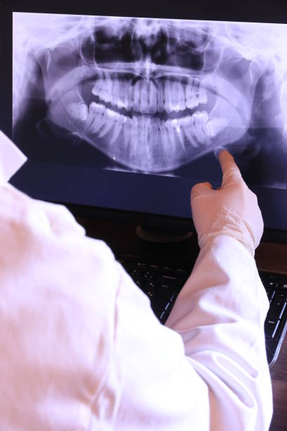 Best Emergency Root Canal Treatment in Carrollton, IL